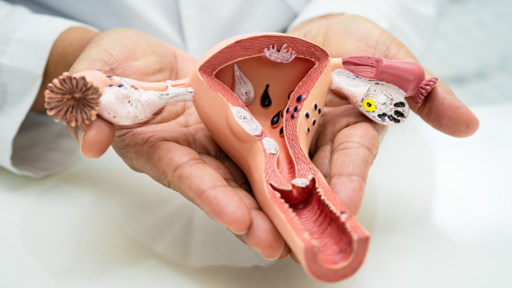 Endometriumbiopsie Untersuchung mittels Pipelle